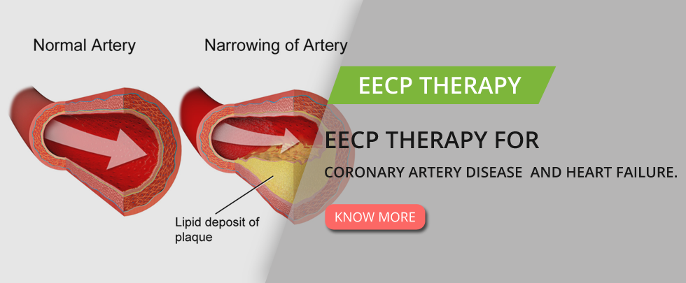 EECP Therapy for Heart Failure
